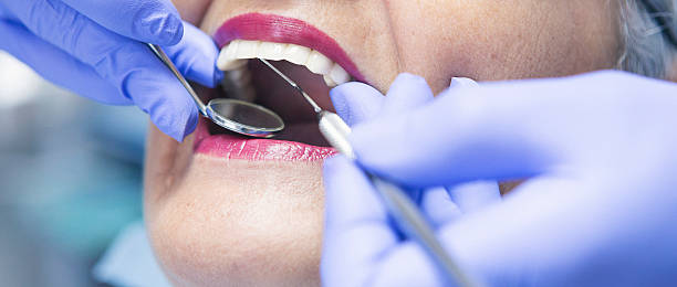 Best Emergency Root Canal Treatment in Weirton, WV